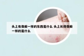 頭上有像癬一樣的東西是什么 頭上長(zhǎng)得像癬一樣的是什么