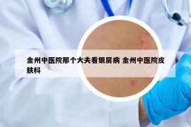 金州中醫(yī)院那個(gè)大夫看銀屑病 金州中醫(yī)院皮膚科