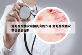 復(fù)方醋酸曲安奈德乳膏的作用 復(fù)方醋酸曲安奈德乳膏圖片