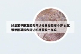 過氧苯甲酰凝膠和阿達帕林凝膠哪個好 過氧苯甲酰凝膠和阿達帕林凝膠一樣嗎