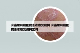 濟(jì)南銀屑病醫(yī)院患者康復(fù)病例 濟(jì)南銀屑病醫(yī)院患者康復(fù)病例查詢