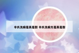 辛氏洗癬是真是假 辛氏洗癬方是真是假