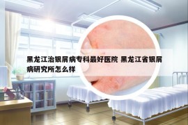 黑龍江治銀屑病專科最好醫(yī)院 黑龍江省銀屑病研究所怎么樣