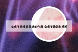 女貞子治療銀屑病的作用 女貞子治婦科病嗎