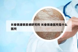 長春銀康銀屑病研究院 長春銀康醫(yī)院是什么醫(yī)院
