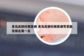 青島皮膚科銀屑病 青島皮膚科銀屑病專家醫(yī)生排名第一名