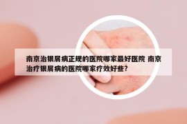 南京治銀屑病正規(guī)的醫(yī)院哪家最好醫(yī)院 南京治療銀屑病的醫(yī)院哪家療效好些?
