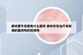 廊坊看牛皮癬有什么醫(yī)院 廊坊市有治療皮膚病的醫(yī)院嗎的短視頻