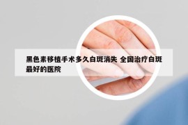 黑色素移植手術(shù)多久白斑消失 全國(guó)治療白斑最好的醫(yī)院