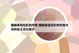 醋酸氟輕松酊的作用 醋酸氟輕松酊的作用與功效娃兒可以用不
