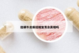 隱瞞牛皮癬結(jié)婚復(fù)發(fā)會(huì)離婚嗎