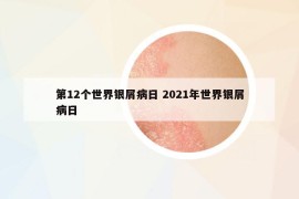 第12個(gè)世界銀屑病日 2021年世界銀屑病日