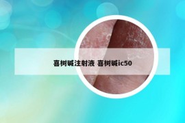 喜樹堿注射液 喜樹堿ic50