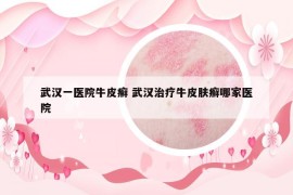 武漢一醫(yī)院牛皮癬 武漢治療牛皮膚癬哪家醫(yī)院