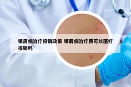 銀屑病治療報銷政策 銀屑病治療費可以醫(yī)療報銷嗎