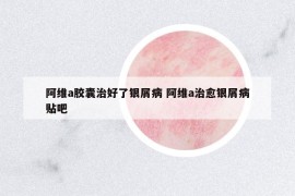 阿維a膠囊治好了銀屑病 阿維a治愈銀屑病貼吧