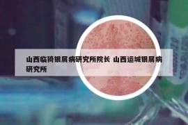 山西臨猗銀屑病研究所院長 山西運(yùn)城銀屑病研究所