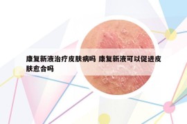 康復新液治療皮膚病嗎 康復新液可以促進皮膚愈合嗎