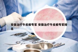 安徽治療牛皮癬專家 安徽治療牛皮癬專家排名