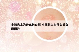 小孩頭上為什么長(zhǎng)白斑 小孩頭上為什么長(zhǎng)白斑圖片