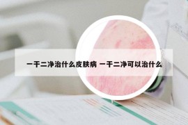 一干二凈治什么皮膚病 一干二凈可以治什么