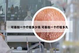 可善挺一個(gè)療程多少錢(qián) 可善挺一個(gè)療程多久