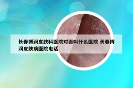 長春博潤皮膚科醫(yī)院對面叫什么醫(yī)院 長春博潤皮膚病醫(yī)院電話