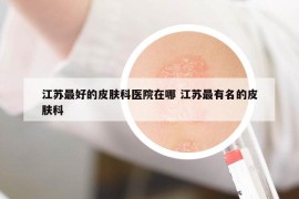 江蘇最好的皮膚科醫(yī)院在哪 江蘇最有名的皮膚科