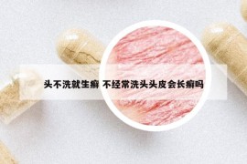 頭不洗就生癬 不經(jīng)常洗頭頭皮會長癬嗎