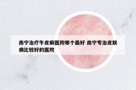 南寧治療牛皮癬醫(yī)院哪個最好 南寧專治皮膚病比較好的醫(yī)院