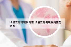 卡泊三醇出現(xiàn)耐藥性 卡泊三醇出現(xiàn)耐藥性怎么辦
