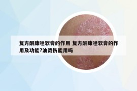 復(fù)方酮康唑軟膏的作用 復(fù)方酮康唑軟膏的作用及功能?油燙傷能用嗎