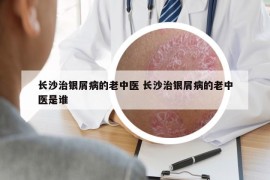 長沙治銀屑病的老中醫(yī) 長沙治銀屑病的老中醫(yī)是誰