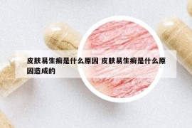 皮膚易生癬是什么原因 皮膚易生癬是什么原因造成的