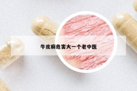 牛皮癬危害大一個老中醫(yī)