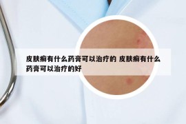 皮膚癬有什么藥膏可以治療的 皮膚癬有什么藥膏可以治療的好
