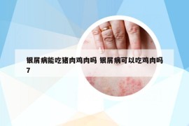 銀屑病能吃豬肉雞肉嗎 銀屑病可以吃雞肉嗎7