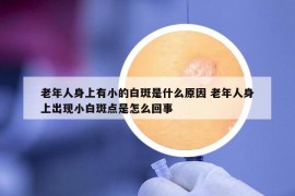 老年人身上有小的白斑是什么原因 老年人身上出現(xiàn)小白斑點(diǎn)是怎么回事