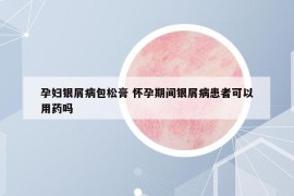 孕婦銀屑病包松膏 懷孕期間銀屑病患者可以用藥嗎