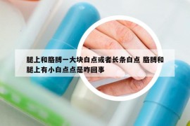 腿上和胳膊一大塊白點或者長條白點 胳膊和腿上有小白點點是咋回事