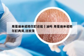 用蔓迪米諾地爾酊還能焗油嗎 用蔓迪米諾地爾酊兩周,狂脫發(fā)