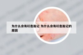 為什么會有紅色胎記 為什么會有紅色胎記的原因