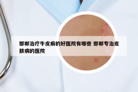 邯鄲治療牛皮癬的好醫(yī)院有哪些 邯鄲專(zhuān)治皮膚病的醫(yī)院