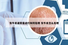 生牛皮通常是進(jìn)行如何處理 生牛皮怎么處理
