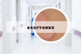 金木浴療牛皮癬復(fù)發(fā)