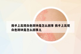我手上出現(xiàn)白色斑塊是怎么回事 我手上出現(xiàn)白色斑塊是怎么回事兒
