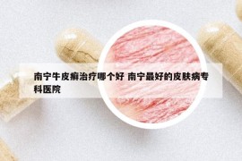 南寧牛皮癬治療哪個(gè)好 南寧最好的皮膚病專(zhuān)科醫(yī)院