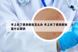 手上長了很多膿包怎么辦 手上長了很多膿包是什么癥狀