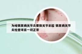 為啥銀屑病關(guān)節(jié)炎要做關(guān)節(jié)彩超 銀屑病關(guān)節(jié)炎檢查項(xiàng)目一切正常