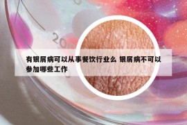 有銀屑病可以從事餐飲行業(yè)么 銀屑病不可以參加哪些工作
